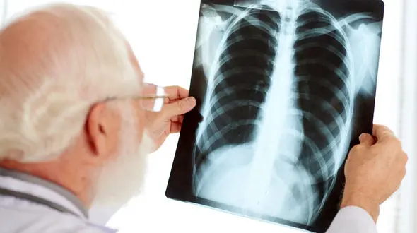 فیلم / چرا افراد مبتلا به آسم حساسیت ریه بیشتری دارند؟ توضیح مبتنی بر تحقیقات پزشکی