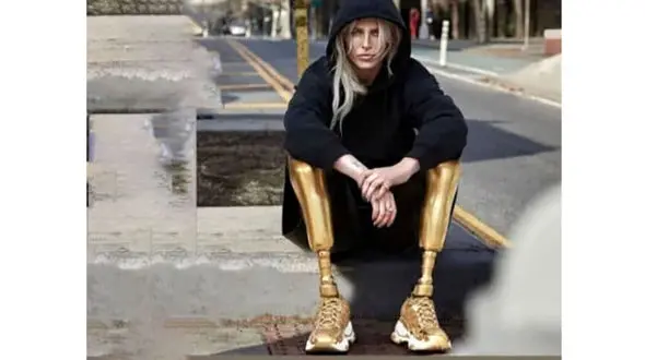 قطع شدن پاهای خانم سوپر مدل / علت چه بود؟ + عکس پاهای مصنوعی 