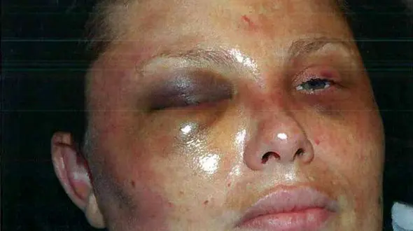 این زن با چکش کتک خورد / او مجبور شد سرپا بخوابد و چیزهای عجیبی بخورد!+ عکس