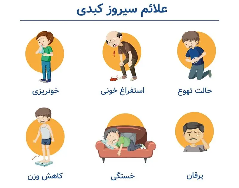 علائم سیروز کبدی
