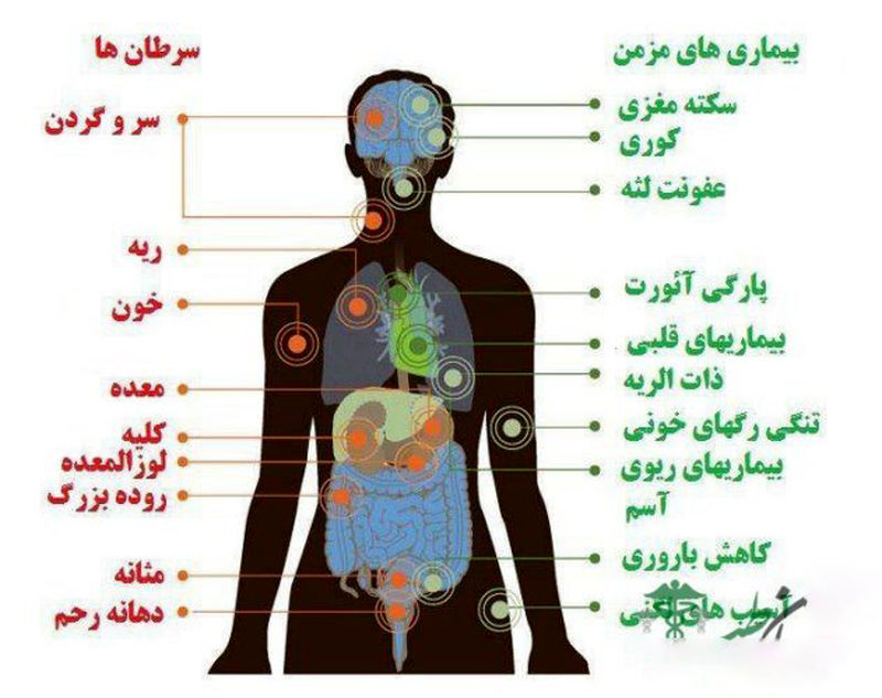 مضرات قلیان