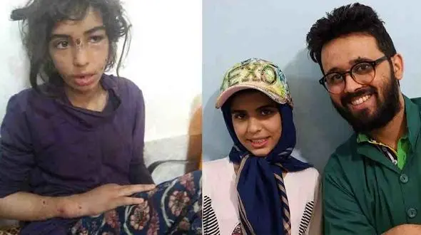 بازگشت لبنخد به صورت فاطمه، دختر شکنجه دیده ماهشهری + عکس