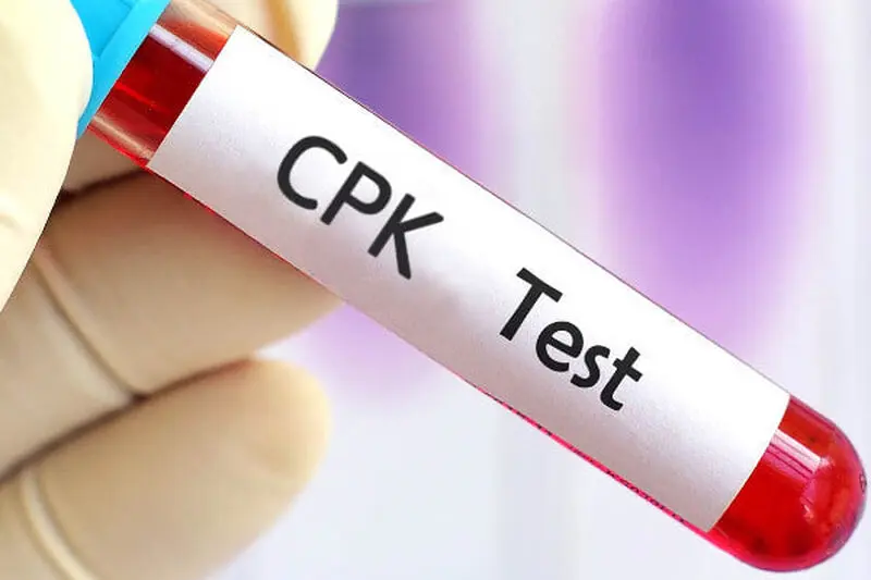 آزمایش CPK
