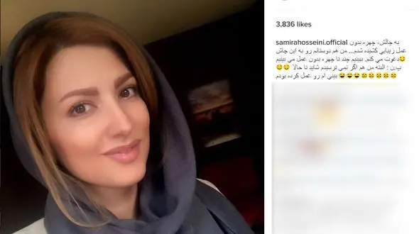 بازیگر زن مشهور ایرانی به چالش "چهره بدون عمل زیبایی" پیوست! +عکس 