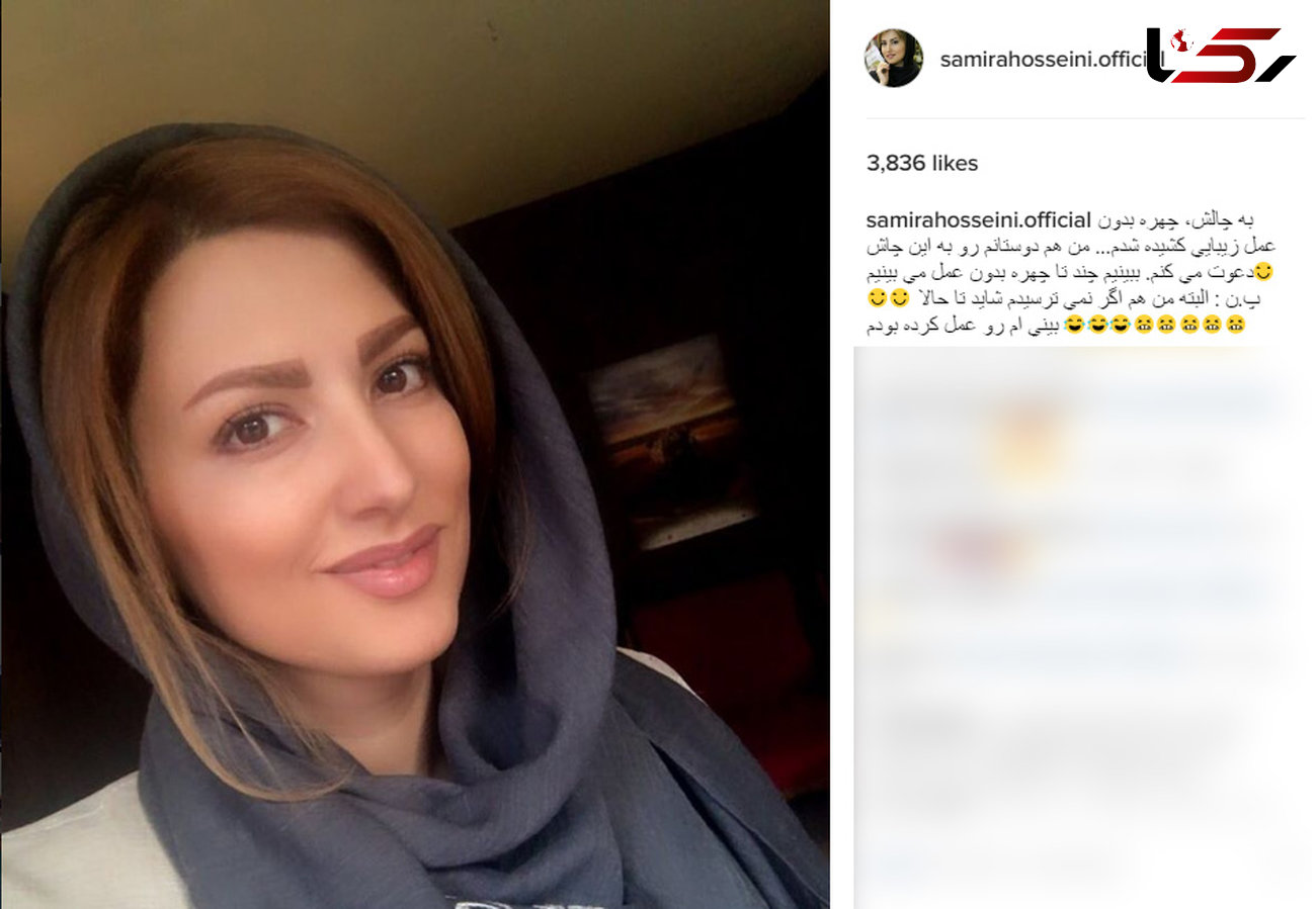 بازیگر زن مشهور ایرانی به چالش "چهره بدون عمل زیبایی" پیوست! +عکس 
