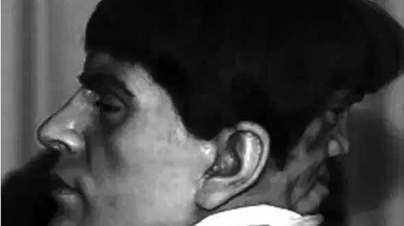 معمای مردی که در پشت سرش یک صورت عجیب داشت+ عکس