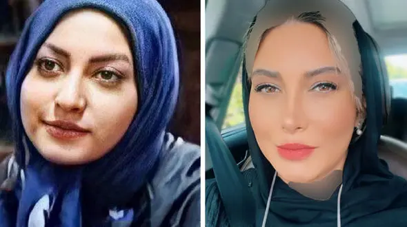  تغییر شوک آور چهره بازیگران زن و مرد ایرانی ! / باورتان نمی شود ! + عکس ها