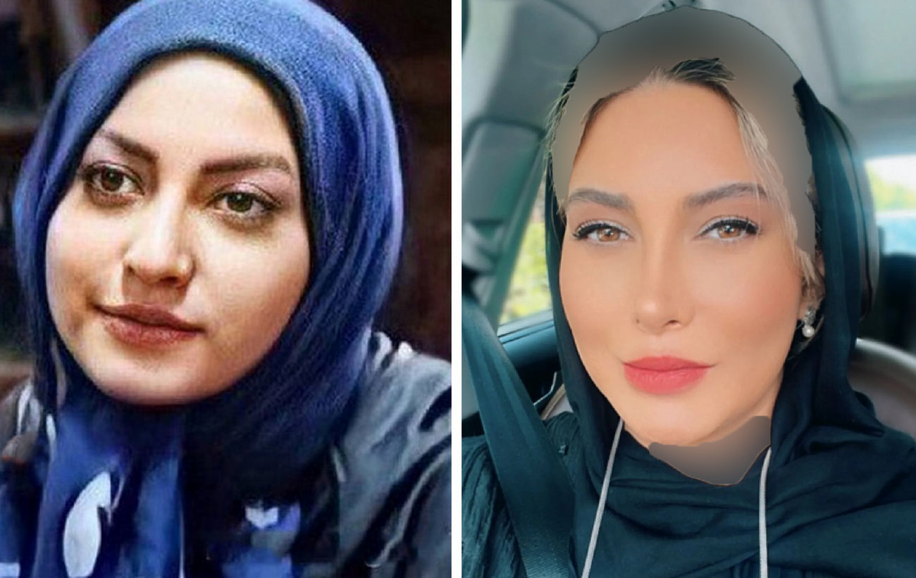  تغییر شوک آور چهره بازیگران زن و مرد ایرانی ! / باورتان نمی شود ! + عکس ها