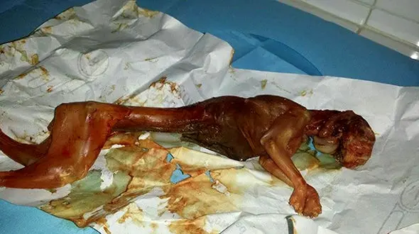 زن جوان خرگوش زایید ! + عکس