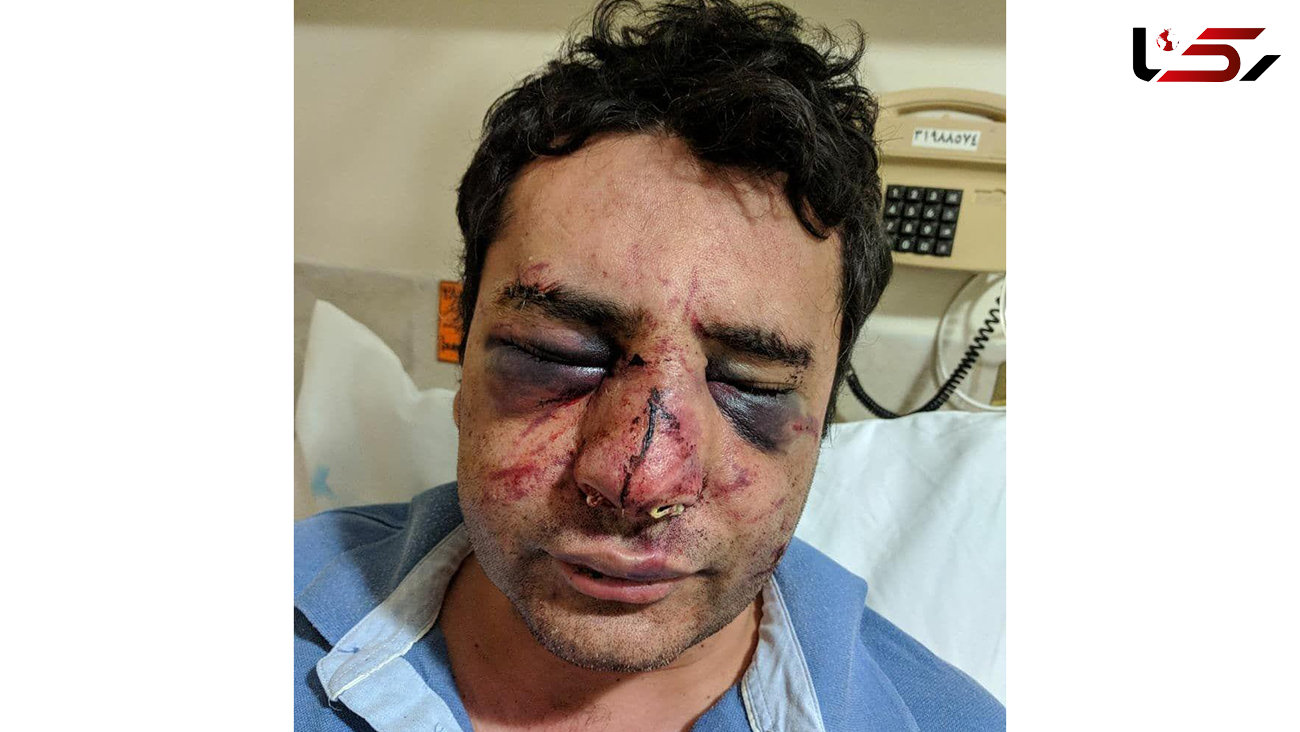 کور شدن دکتر پیرانشهری در حمله بستگان فوتی کرونایی به بیمارستان + عکس دردناک