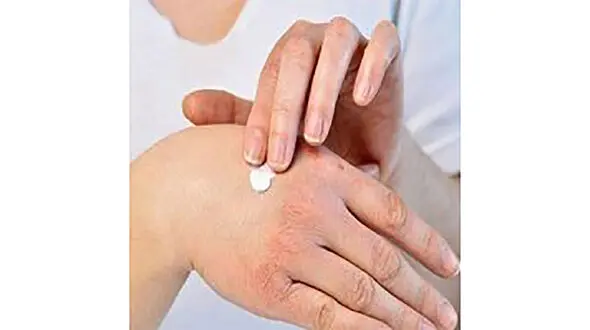 عوامل موثر بر خرابی پوست کدامند؟