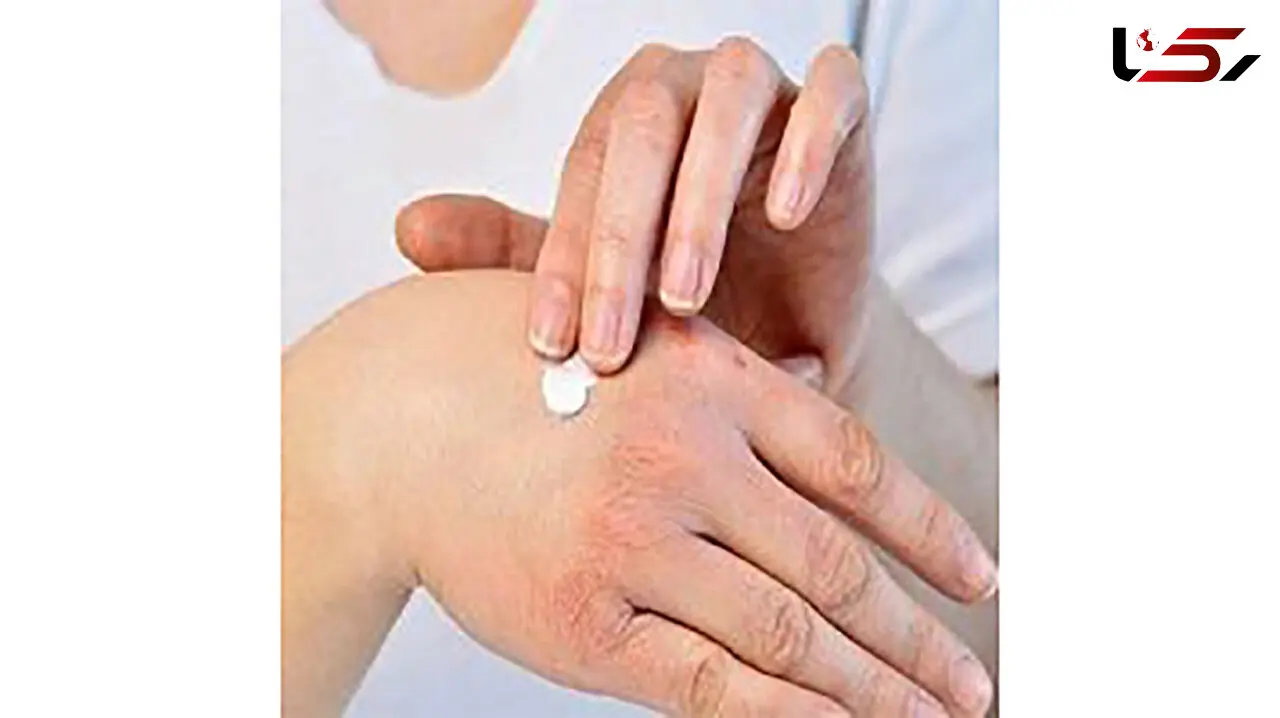 با این خوراکی ها به جنگ خشکی پوست بروید
