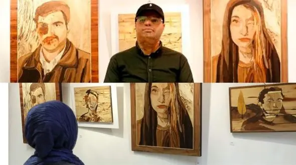 اسید هایی که بی رحمانه جسم و روح می سوزانند!  / زنان بیشتر اسید سوخته اند یا مردان ؟!