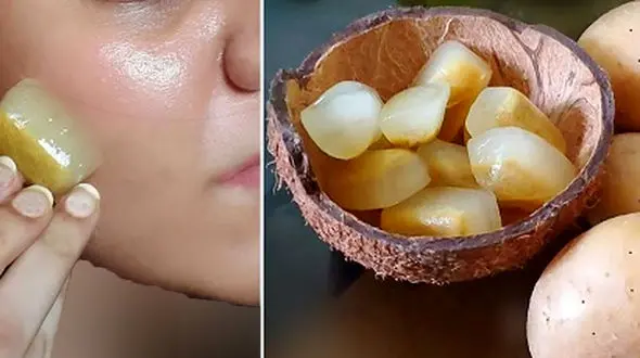 سیب زمینی، دشمن لک پوستی