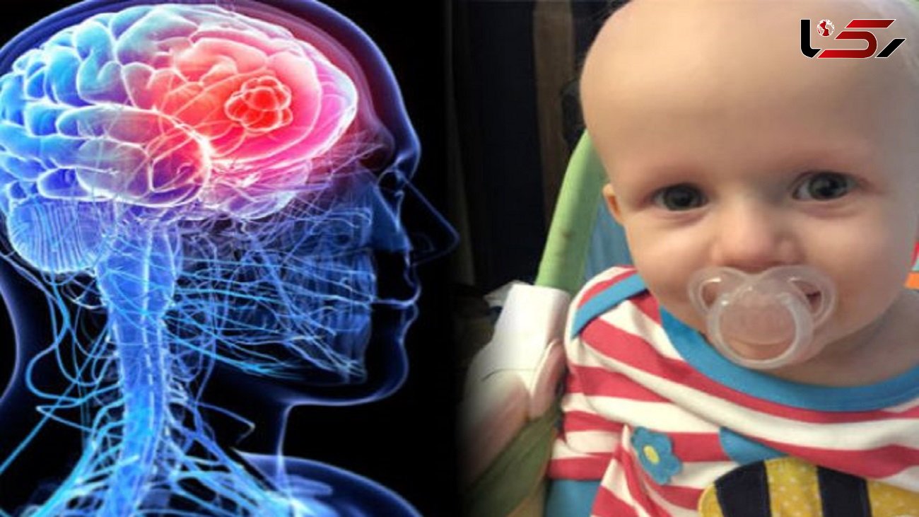 درمان تومور مغزی کودکان با استفاده از یک ویروس