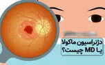 ماکولار چیست؟ / اختلالات ماکولار در چشم و بینایی