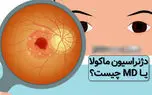 ماکولار چیست؟ / اختلالات ماکولار در چشم و بینایی