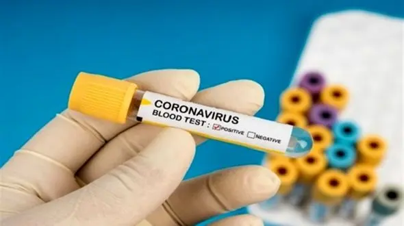  کرونا از راه مدفوع نیز منتقل می‌‌شود