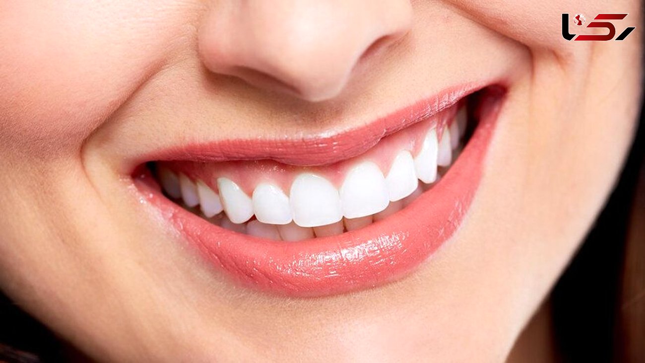 8 راه مهم برای داشتن دندان‌های سالم