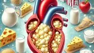 لبنیات پرچرب؛ دشمن قلب و کلسترول یا بخشی از یک رژیم سالم؟