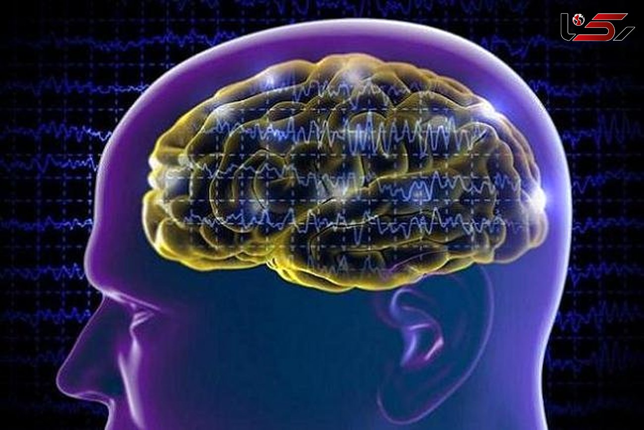 ارتباط زوال عقل با آسیب های مغزی در نوجوانی