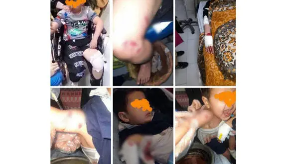 ترس و وحشت در مرند پس از حمله سگ‌ ولگرد