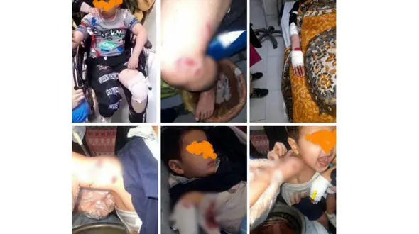 ترس و وحشت در مرند پس از حمله سگ‌ ولگرد