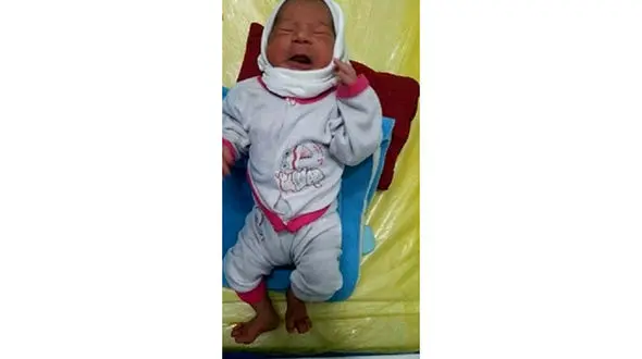  تولد نوزاد پسر با 24 انگشت در گناباد + عکس 