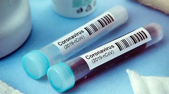  تا چه زمانی ویروس کرونا مهمان ماست؟ 