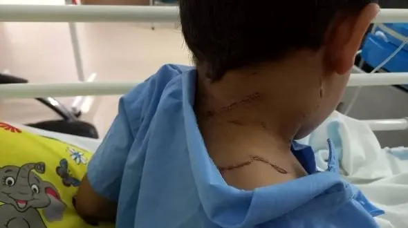 حمله سگ تعمیرگاه به پسربچه تهرانی در خیابان