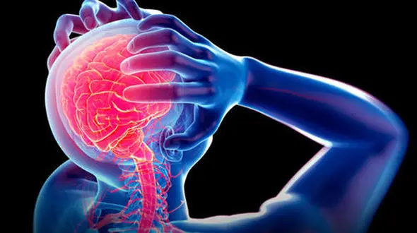 باورهای اشتباه درباره میگرن 