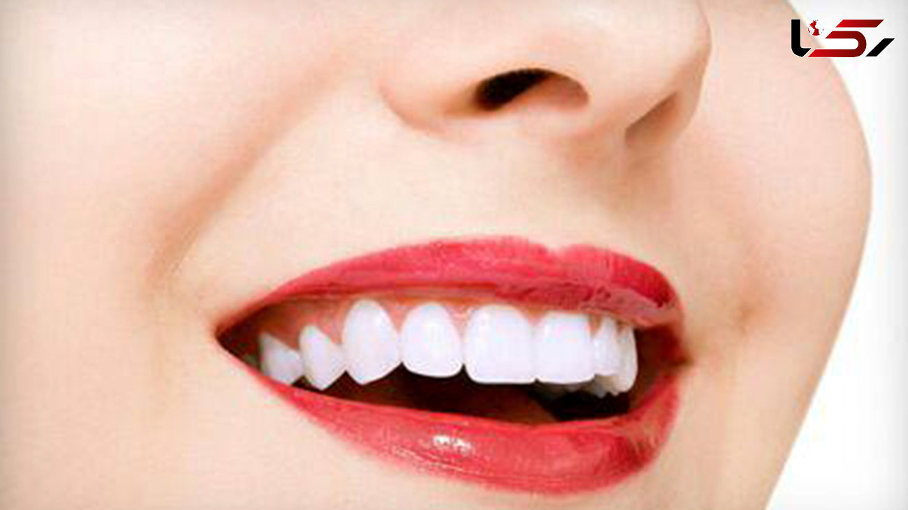 پوست موز دندان‌هایتان را سفید می کند!