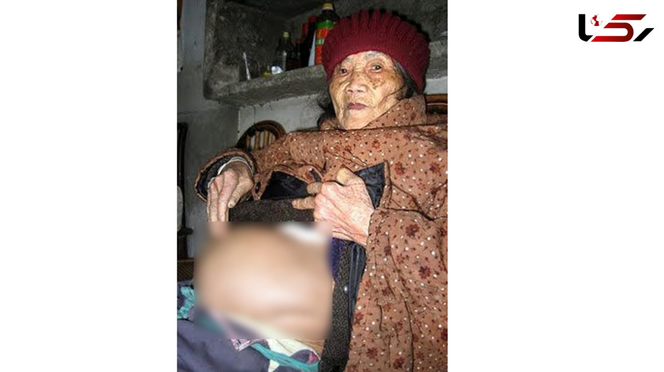 زن 92 ساله جنین سنگی زایمان کرد ! + عکس
