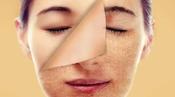 عوارض کمبود کلاژن + راه‌ های افزایش کلاژن