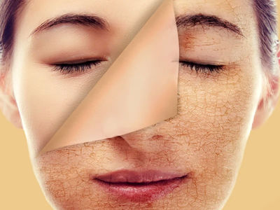 عوارض کمبود کلاژن + راه‌ های افزایش کلاژن
