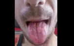 بلایی وحشتناکی که نوشابه انرژی زا بر سر معلم جوان آورد +عکس