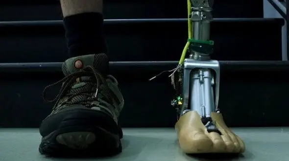 قوزک پای مصنوعی مانند یک پای واقعی عمل می کند+عکس