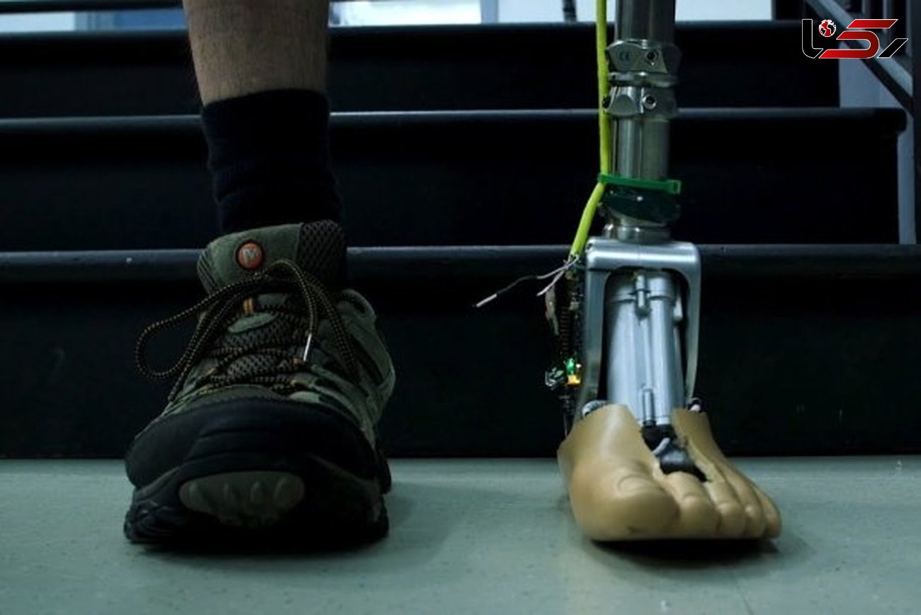 قوزک پای مصنوعی مانند یک پای واقعی عمل می کند+عکس