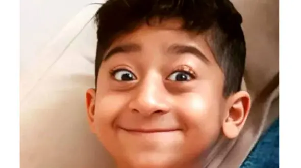 تغییر عجیب کچلیک در نوجوانی /  کچلیک چه معنایی دارد ! + عکس ها