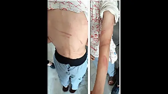 شلاق زدن کودکان دوقلو توسط مادر مشهدی ! + عکس تکاندهنده