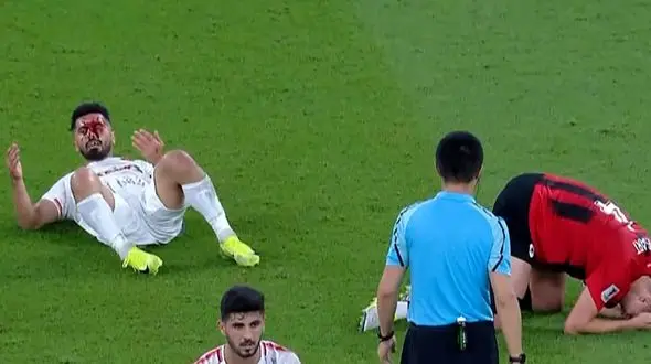 آخرین وضعیت امید عالیشاه پس از مصدومیت دلخراش / استقلالی ها هم نگران شدند!