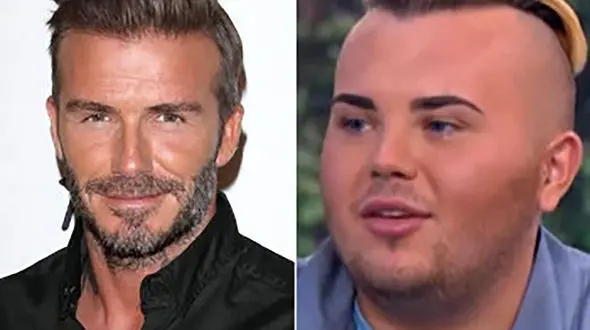 جراحی پلاستیک پسر جوان برای  دیوید بکهام شدن ! = عکس های قبل و بعد را ببینید !