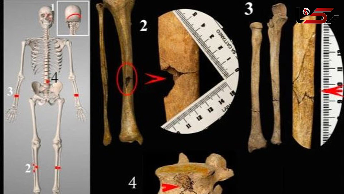کشف حیرت آور از اسکلت 600 ساله در ایتالیا + عکس
