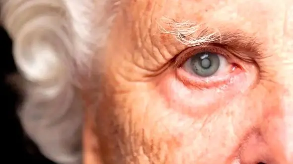 روش‌ های جدید برای پیشگیری از بیماری آب‌سیاه