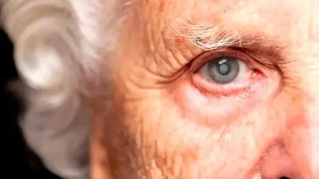 روش‌ های جدید برای پیشگیری از بیماری آب‌سیاه