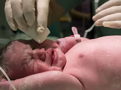 نجات جان یک نوزاد با ویرایش ژنِ شخصیسازیشده ../ جزییات شگفت انگیز از درمان نوین ویرایش ژنی