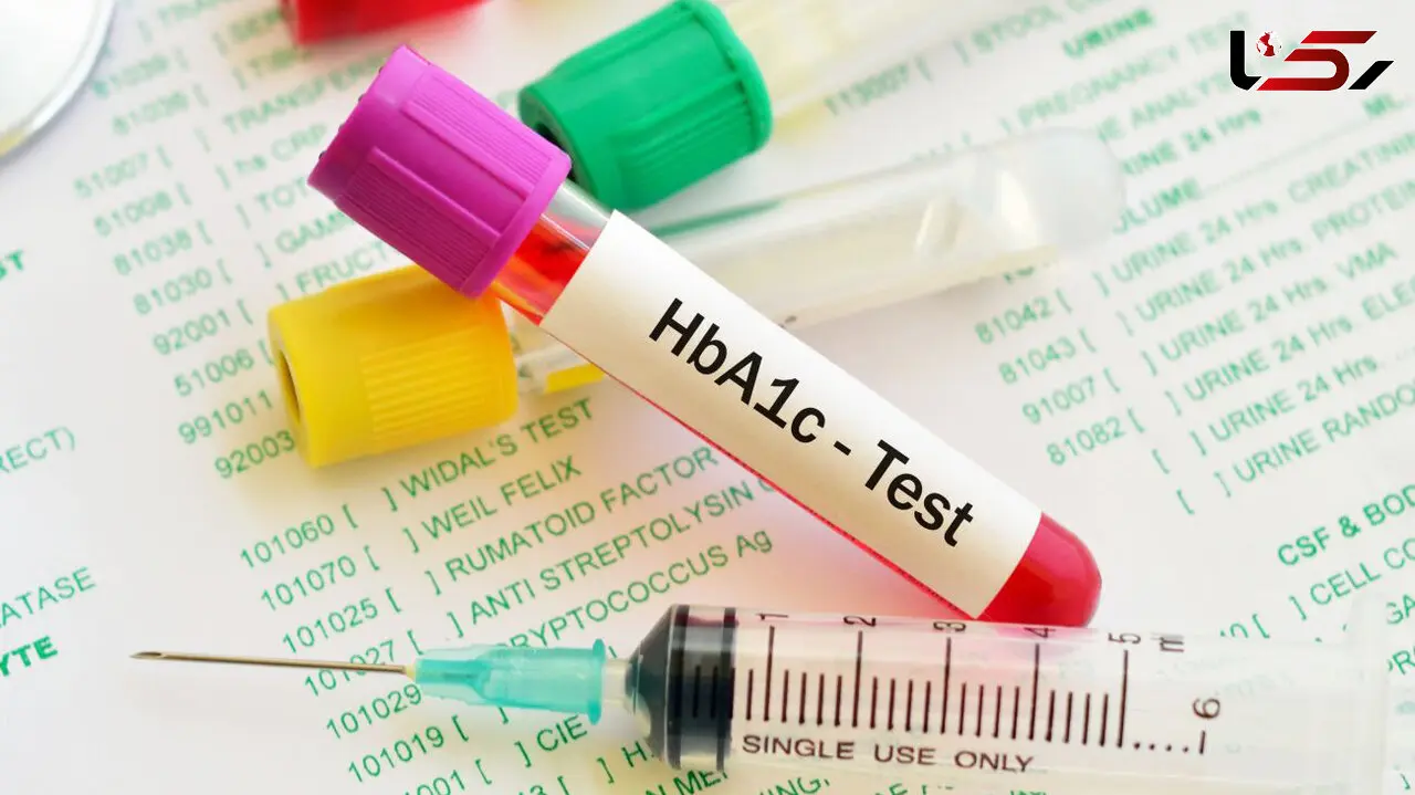 hba1c چیست؟ / جدول تفسیر نتایج آزمایش HbA1c