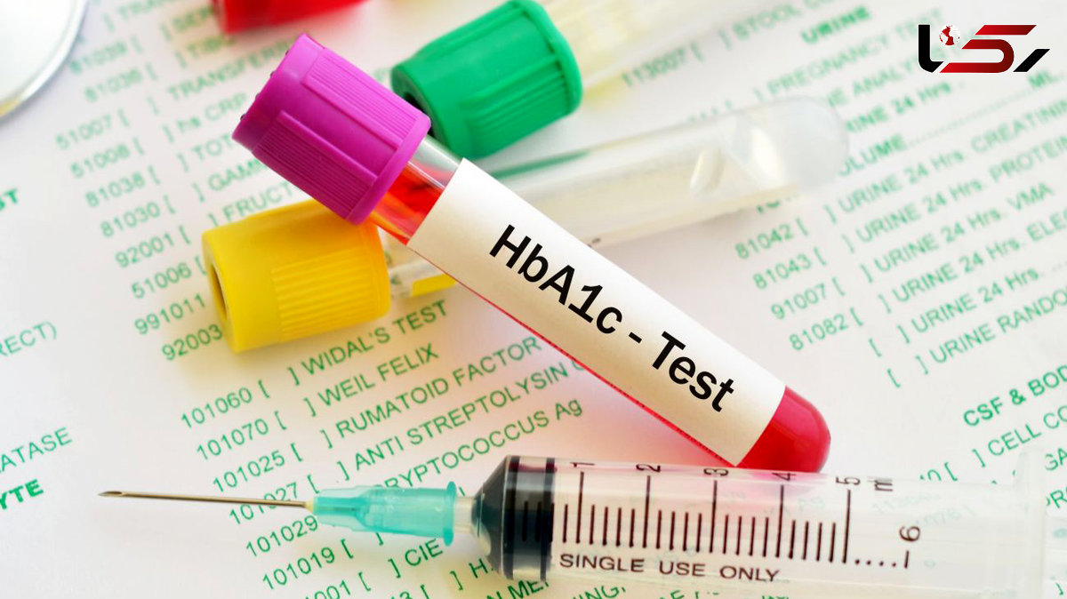 hba1c چیست؟ / جدول تفسیر نتایج آزمایش HbA1c