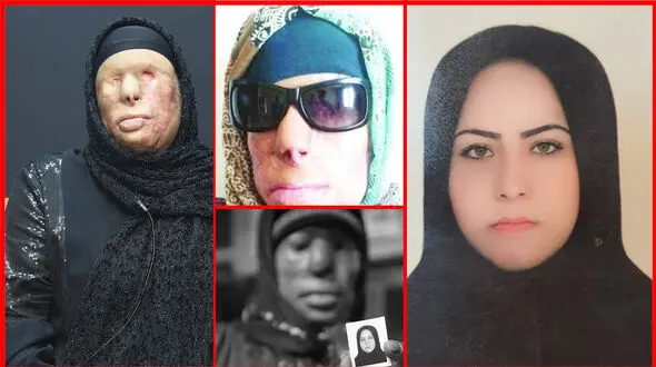  هولناکترین اسیدپاشی به مادر و دختر ! / زیور کور شد دخترش کشته شد + فیلم و عکس 