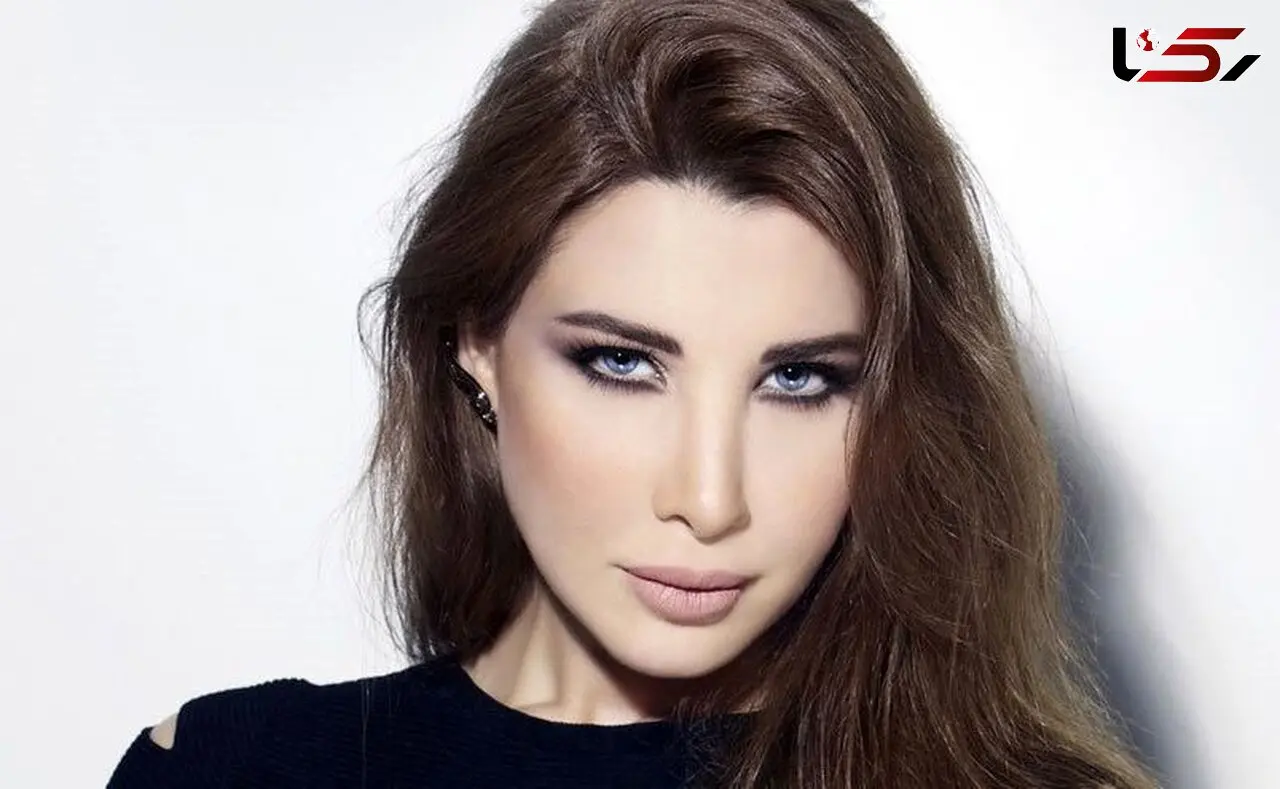 زشتی باورنکردنی نانسی عجرم قبل عمل زیبایی / چه بود و چه شد!